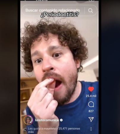 FALSO; dentistas en redes sociales señalan que Luisito Comunica NO perdió sus dientes (VIDEO). INSTAGRAM/LUISITOCOMUNICA