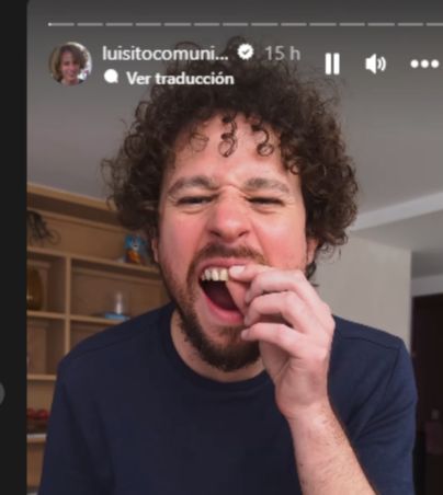 Esto es lo que en verdad paso con los dientes de Luisito Comunica. INSTAGRAM/LUISITO COMUNICA